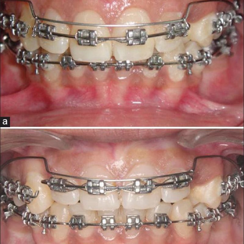 phuong phap danh lun trong chinh nha 10