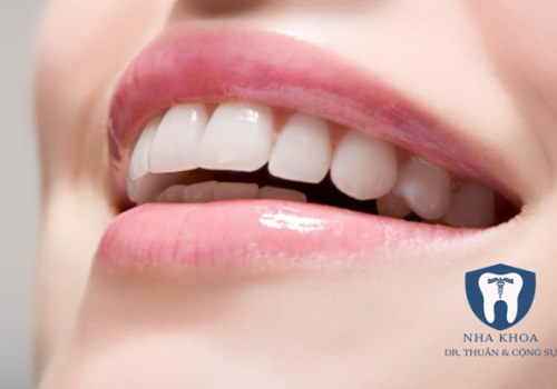 Tổng hợp các kết quả Niềng răng bởi Thạc sĩ-bác sĩ Đinh Hải Thịnh