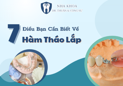 7 Điều Bạn Cần Biết Về Hàm Tháo Lắp