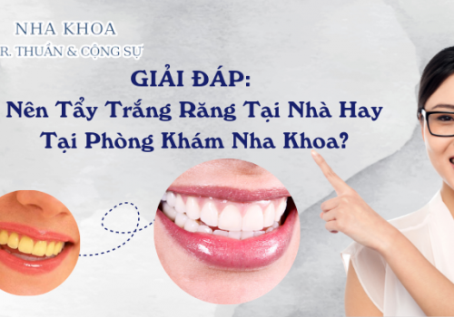 GIẢI ĐÁP: Nên Tẩy Trắng Răng Tại Nhà Hay Phòng Khám Nha Khoa?