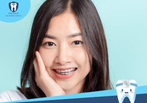 Niềng răng mắc cài kim loại là gì? Quy trình như thế nào?