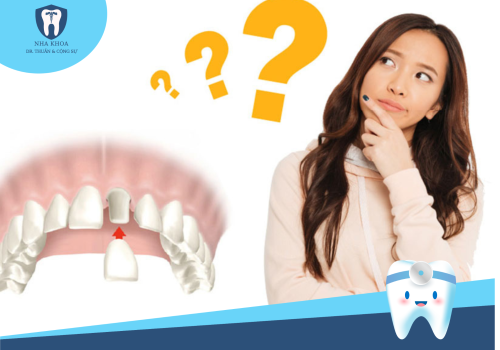 CÓ NÊN BỌC RĂNG SỨ KHÔNG? NHỮNG TRƯỜNG HỢP KHÔNG NÊN BỌC RĂNG SỨ