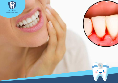 BỆNH VIÊM NHA CHU: NGUYÊN NHÂN, DẤU HIỆU VÀ CÁCH ĐIỀU TRỊ VIÊM NHA CHU