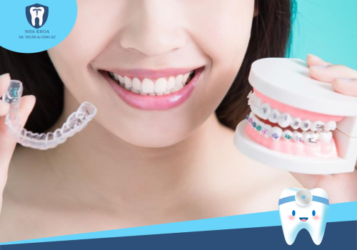 6 BƯỚC TRONG QUÁ TRÌNH NIỀNG RĂNG TRONG SUỐT BẠN CẦN NẮM RÕ