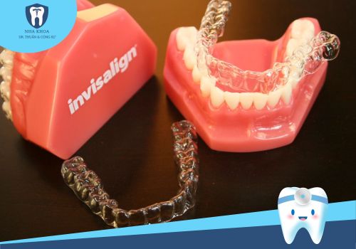 Niềng răng invisalign và 5 ưu điểm vượt trội