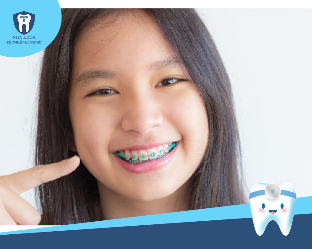 tiền chỉnh nha cho trẻ em(1)